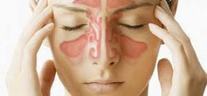 La rinosinusitis es la inflamación de la mucosa que recubre la nariz y los senos paranasales