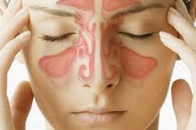 La-rinosinusitis-es-la-inflamación-de-la-mucosa-que-recubre-la-nariz-y-los-senos-paranasales.jpeg