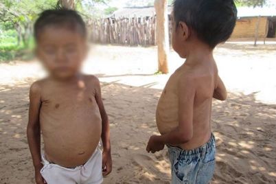 Niños-desnutridos-La-Guajira.jpg